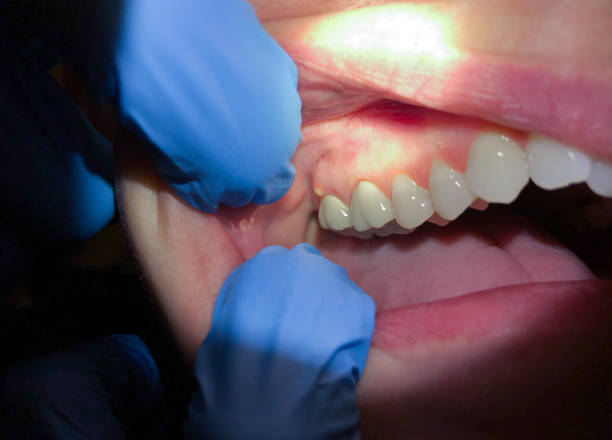 Best Mobile Emergency Dentist in North Kansas City, MO